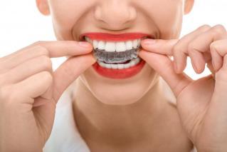 Why Invisalign® Is a Great Choice for Straightening Teeth